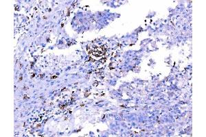 IHC analysis of SH3GL2 using anti-SH3GL2 antibody (ABIN7602229). (SH3G2 anticorps  (AA 65-292))