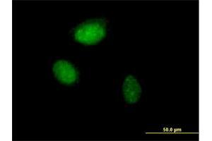 Immunofluorescence of purified MaxPab antibody to ZNF215 on HeLa cell. (ZNF215 anticorps  (AA 1-304))