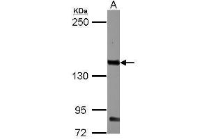 WB Image Sample (30 ug of whole cell lysate) A: K562 5% SDS PAGE antibody diluted at 1:1000 (CD131 anticorps  (Center))