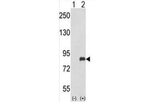 Western blot analysis of ADRBK2 (arrow) using rabbit polyclonal ADRBK2 Antibody
