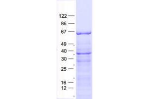 Validation with Western Blot