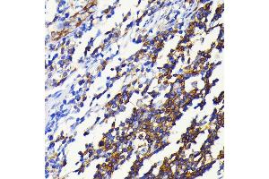 Immunohistochemistry of paraffin-embedded human appendix using NF-κB2 antibody (ABIN7268983) at dilution of 1:100 (40x lens). (NFKB2 anticorps)
