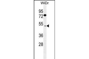 RMD1 Antibody (N-term) (ABIN655830 and ABIN2845248) western blot analysis in WiDr cell line lysates (35 μg/lane). (RMD1 anticorps  (N-Term))