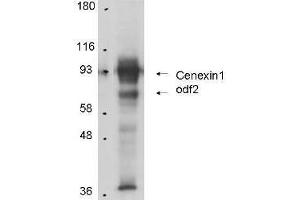 Anti-Cenexin-1 in Western Blot using  Immunochemical's Protein A Purified Anti-Cenexin-1 antibody shows detection of Cenexin-1 in total cell lysates from mouse F9 embryonic carcinoma cells. (ODF2 anticorps)