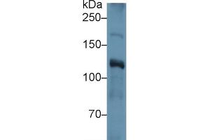 Detection of ITIH4 in Human Lung lysate using Polyclonal Antibody to Inter Alpha-Globulin Inhibitor H4 (ITIH4)
