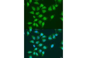 Immunofluorescence analysis of U2OS cells using EYA3 antibody (ABIN6292902) at dilution of 1:100. (EYA3 anticorps)