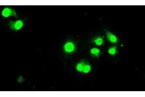 Image no. 6 for anti-Signal Transducer and Activator of Transcription 1, 91kDa (STAT1) antibody (ABIN1501168) (STAT1 anticorps)