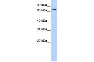 WB Suggested Anti-SLC11A2 Antibody Titration:  0. (SLC11A2 anticorps  (N-Term))
