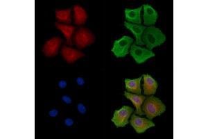 ABIN6262812 and ABIN6278290 staining Hela cells by IF/ICC.