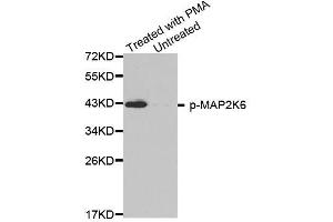 Western blot analysis of extracts from HL60 cells, using phospho-MAP2K6-S207 antibody (ABIN2988139). (MAP2K6 anticorps  (pSer207))
