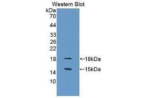 Western blot analysis of the recombinant protein. (GDF3 anticorps  (AA 253-366))