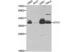 Western Blotting (WB) image for anti-Ets Variant 7 (ETV7) antibody (ABIN1882381) (ETV7 anticorps)