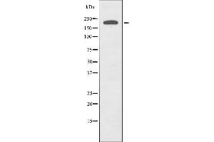 Western blot analysis of extracts from Jurkat cells, using MAST2 antibody.