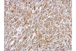IHC-P Image Immunohistochemical analysis of paraffin-embedded C2C12 xenograft, using Plasminogen, antibody at 1:500 dilution.