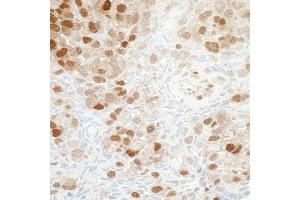 Immunohistochemistry (IHC) image for anti-Nicotinamide phosphoribosyltransferase (NAMPT) (AA 400-450) antibody (ABIN7454014) (Recombinant NAMPT anticorps  (AA 400-450))