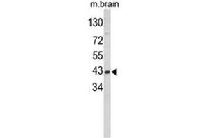 Western blot analysis of GOT1 Antibody (N-term) in mouse brain tissue lysates (35ug/lane). (GOT1 anticorps  (N-Term))