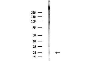 anti-Fms-Related tyrosine Kinase 3 Ligand (FLT3LG) (C-Term) antibody