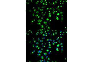 Immunofluorescence analysis of MCF-7 cell using CD86 antibody. (CD86 anticorps)