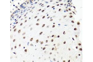 Immunohistochemistry of paraffin-embedded Human esophagus using PRPF8 Polyclonal Antibody at dilution of 1:100 (40x lens). (PRPF8 anticorps)