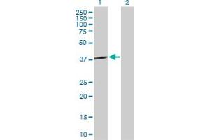 Western Blot analysis of SPO11 expression in transfected 293T cell line by SPO11 MaxPab polyclonal antibody. (SPO11 anticorps  (AA 1-358))