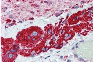 Human Small Intestine, Myenteric Plexus: Formalin-Fixed, Paraffin-Embedded (FFPE) (TUBB2A anticorps  (AA 1-446))