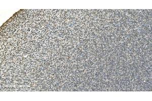 IHC analysis of LSM7 using anti-LSM7 antibody (ABIN7598937). (LSM7 anticorps  (AA 1-103))