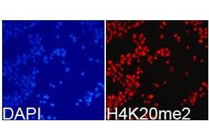Immunofluorescence analysis of 293T cell using H4K20me2 antibody. (Histone 3 anticorps  (2meLys20))