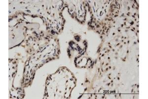 Immunoperoxidase of monoclonal antibody to BCL11A on formalin-fixed paraffin-embedded human placenta.