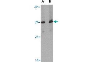 Western blot analysis of Apba1 in mouse spleen tissue lysate with Apba1 polyclonal antibody  at (A) 1 and (B) 2 ug/mL . (APBA1 anticorps  (Internal Region))