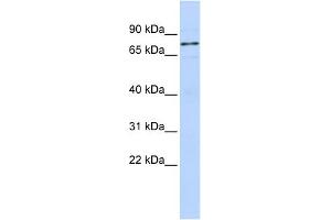 WB Suggested Anti-WBAntibody Titration:  0. (WBP11 anticorps  (N-Term))