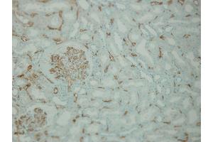 Immunohistochemistry (IHC) image for anti-Complement Component C4d (C4d) (Internal Region) antibody (ABIN870587) (Complement C4d anticorps  (Internal Region))
