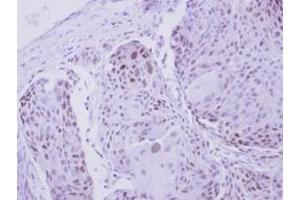 Image no. 1 for anti-Zinc Finger Protein 530 (ZNF530) (AA 1-190) antibody (ABIN1501847)