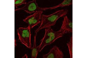 Immunofluorescence analysis of Hela cells using MCM2 mouse mAb (green).