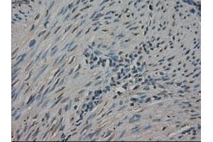 Immunohistochemical staining of paraffin-embedded Ovary tissue using anti-NEK6mouse monoclonal antibody. (NEK6 anticorps)