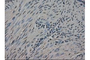 Immunohistochemical staining of paraffin-embedded Ovary tissue using anti-NEK6mouse monoclonal antibody. (NEK6 anticorps)