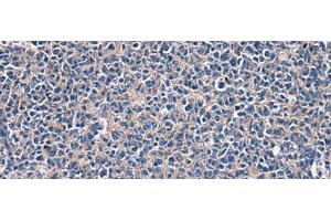 Immunohistochemistry of paraffin-embedded Human tonsil tissue using LAMP3 Polyclonal Antibody at dilution of 1:30(x200) (LAMP3 anticorps)