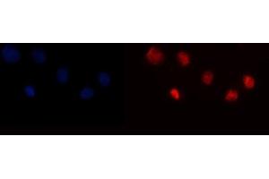 IF analysis of YY1 using anti-YY1 antibody (ABIN6719534). (YY1 anticorps  (Middle Region))