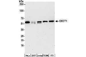 Western Blotting (WB) image for anti-3-Oxoacid CoA Transferase 1 (OXCT1) (AA 25-75) antibody (ABIN7453002)
