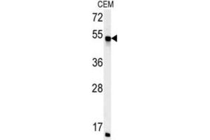 Western Blotting (WB) image for anti-FK506 Binding Protein 8, 38kDa (FKBP8) antibody (ABIN3002504) (FKBP8 anticorps)