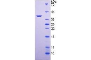 Image no. 1 for Arginase (ARG) (AA 1-323) (Active) protein (His tag) (ABIN6239896) (ARG Protein (AA 1-323) (His tag))
