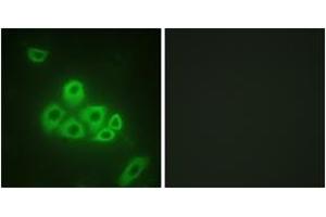 Immunofluorescence analysis of A549 cells, using S1P Receptor EDG1 (Ab-236) Antibody. (S1PR1 anticorps  (AA 206-255))