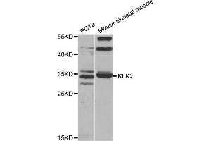 Western blot analysis of extracts of Hela cell lysate, using KLK2 antibody. (Kallikrein 2 anticorps  (AA 25-250))