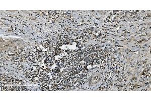 anti-Mitogen-Activated Protein Kinase Kinase Kinase 8 (MAP3K8) (AA 9-193) antibody