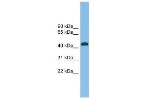 NODAL antibody used at 1 ug/ml to detect target protein.