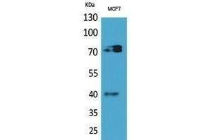 Western Blotting (WB) image for anti-Myeloproliferative Leukemia Virus Oncogene (MPL) (Internal Region) antibody (ABIN3178485) (MPL anticorps  (Internal Region))