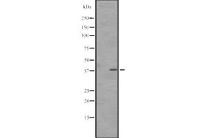 Western blot analysis of SNAPC3 expression in A431 whole cell lysate ,The lane on the left is treated with the antigen-specific peptide.