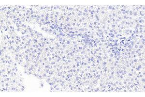 ABIN5872058 Negative Control showing staining of paraffin embedded Human Liver, with no primary antibody. (MGLL anticorps)