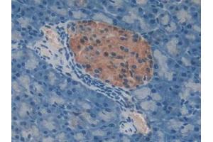 DAB staining on IHC-P; Samples: Mouse Pancreas Tissue