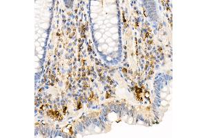 Immunohistochemistry of paraffin-embedded mouse kidney using Ferritin Light Chain Rabbit pAb (ABIN6133515, ABIN6140791, ABIN6140792 and ABIN6218871) at dilution of 1:150 (40x lens).