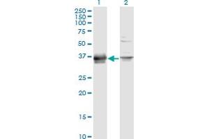 Western Blot analysis of PRSS8 expression in transfected 293T cell line by PRSS8 monoclonal antibody (M11A), clone 3C4.